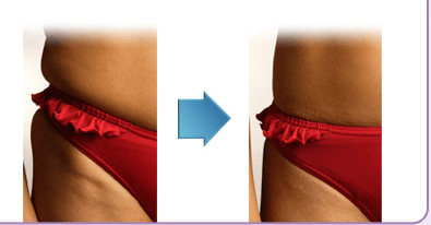 body-wrap-kit